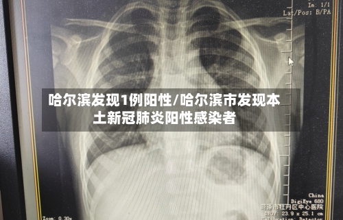 哈尔滨发现1例阳性/哈尔滨市发现本土新冠肺炎阳性感染者